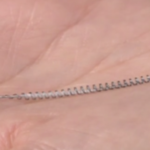 Essure Sterilisation Implant: Growing Health Concerns Over The Permanent Contraception