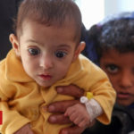 Yemen War: Us Senate Advances Measure To End Support For Saudi Forces