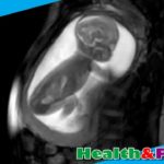 Detailed images of baby heart inside the womb