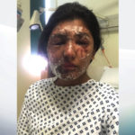 Man charged in connection with acid attack